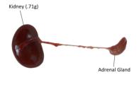 Kidney and Adrenal Gland